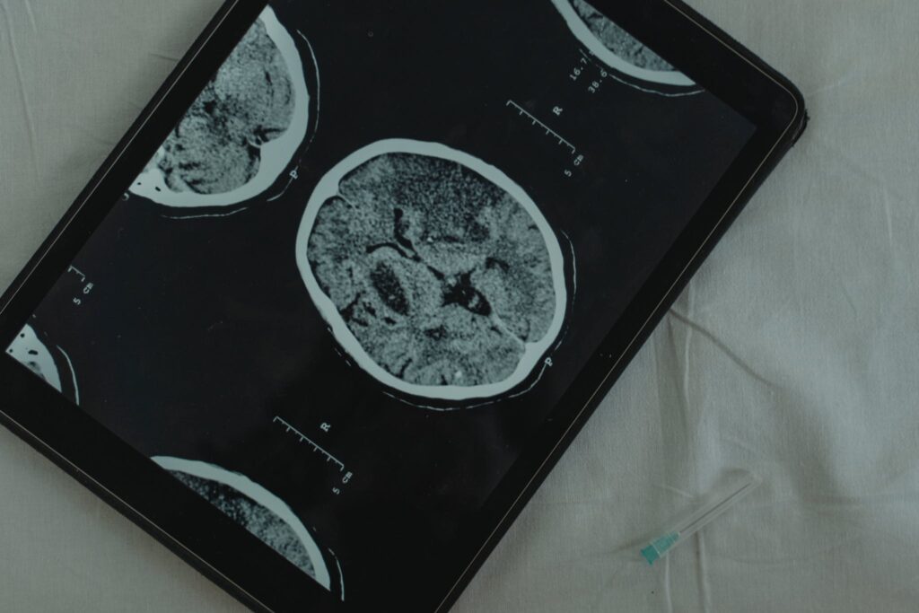 Brain Image on Digital Tablet